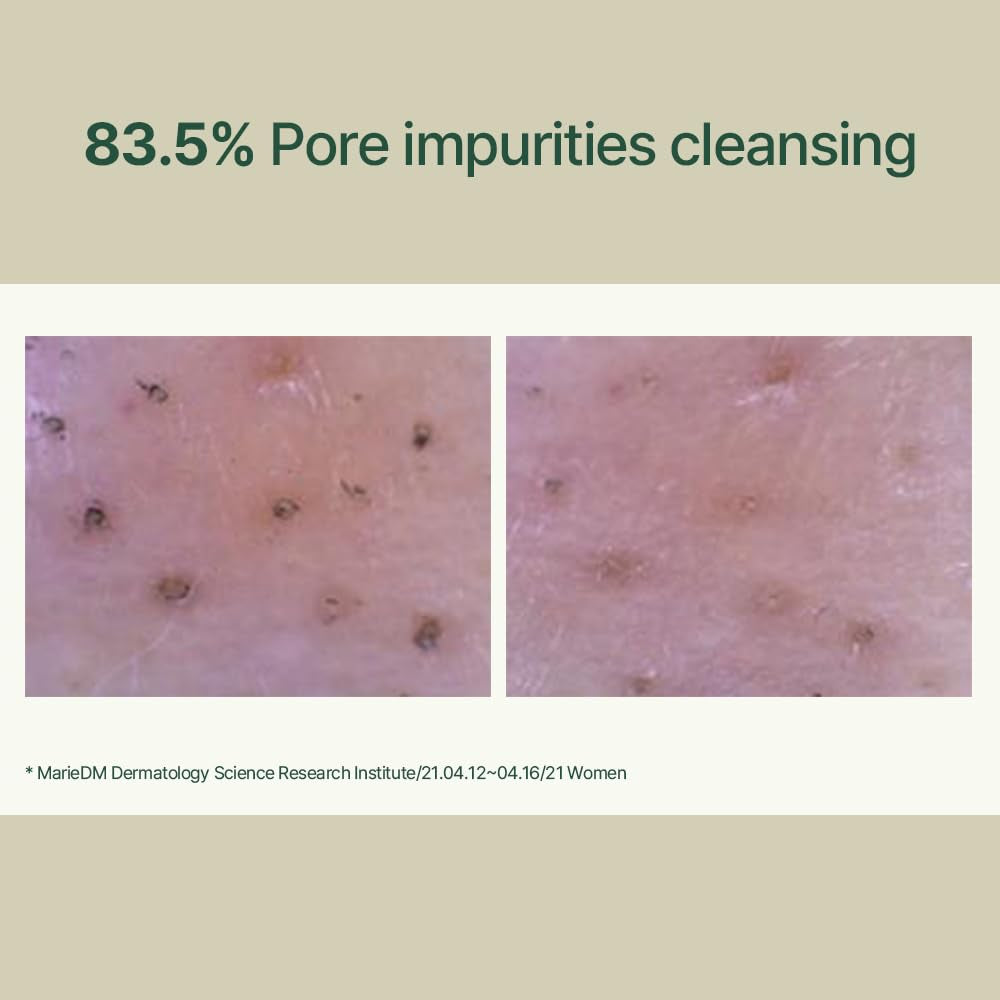 PKY Calming Low Ph Foaming Cleanser | Daily Face Wash & Makeup Remover with Tea Tree, Centella Asiatica, 5 Hyaluronic Acids That Removes Dead Skin Cells, Hydrates Skin - 150Ml 5.07 Fl.Oz.