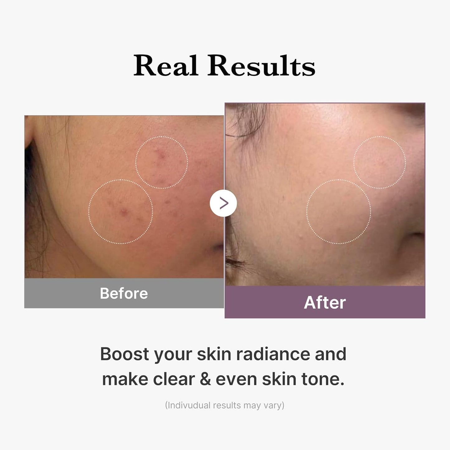 Age-R Glutathione Glow Milky Toner, Low-Irritation Double Layer Toner for Glass Glow Skin with Peptide, Even Skin Tone, Radiance, Hydration, Korean Skincare