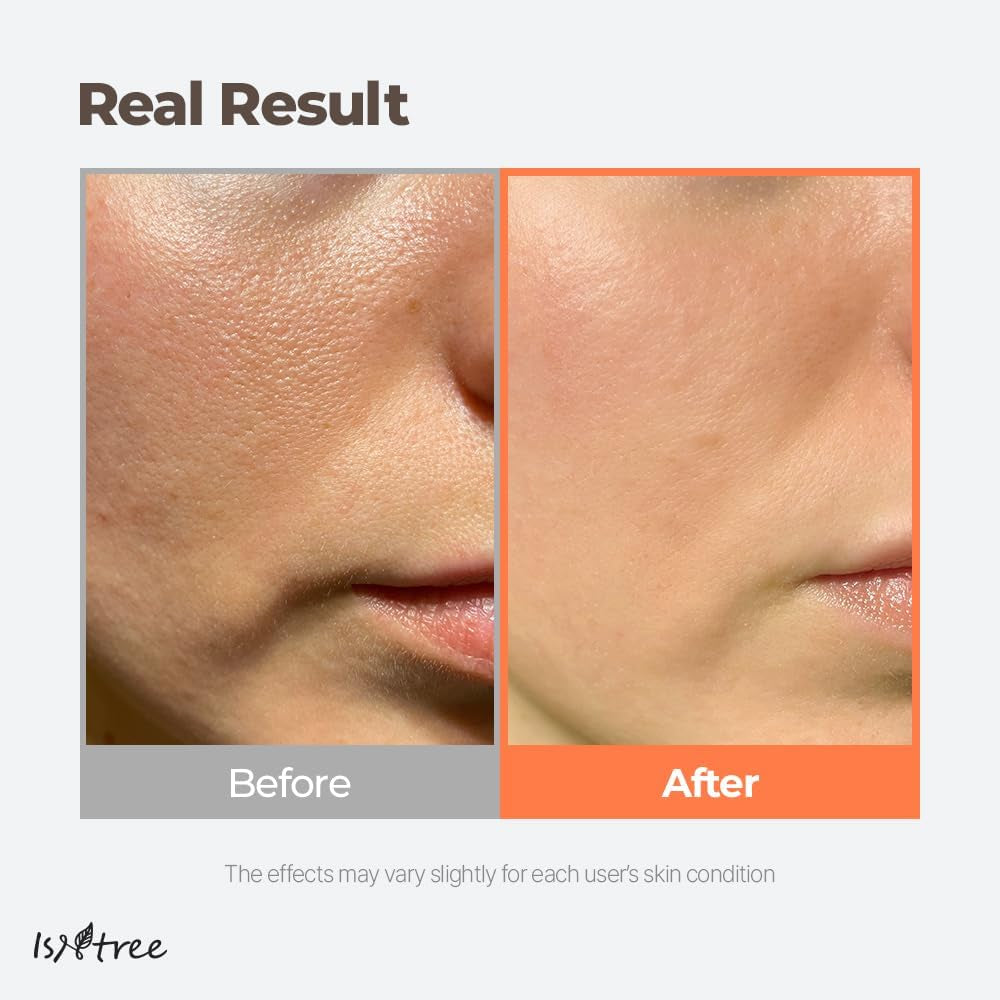 Green Tea Fresh Toner 200Ml, 6.76 Fl.Oz | Korean Skincare | Toner for Oily Skin | Sebum Control | Hydrating and Refreshing