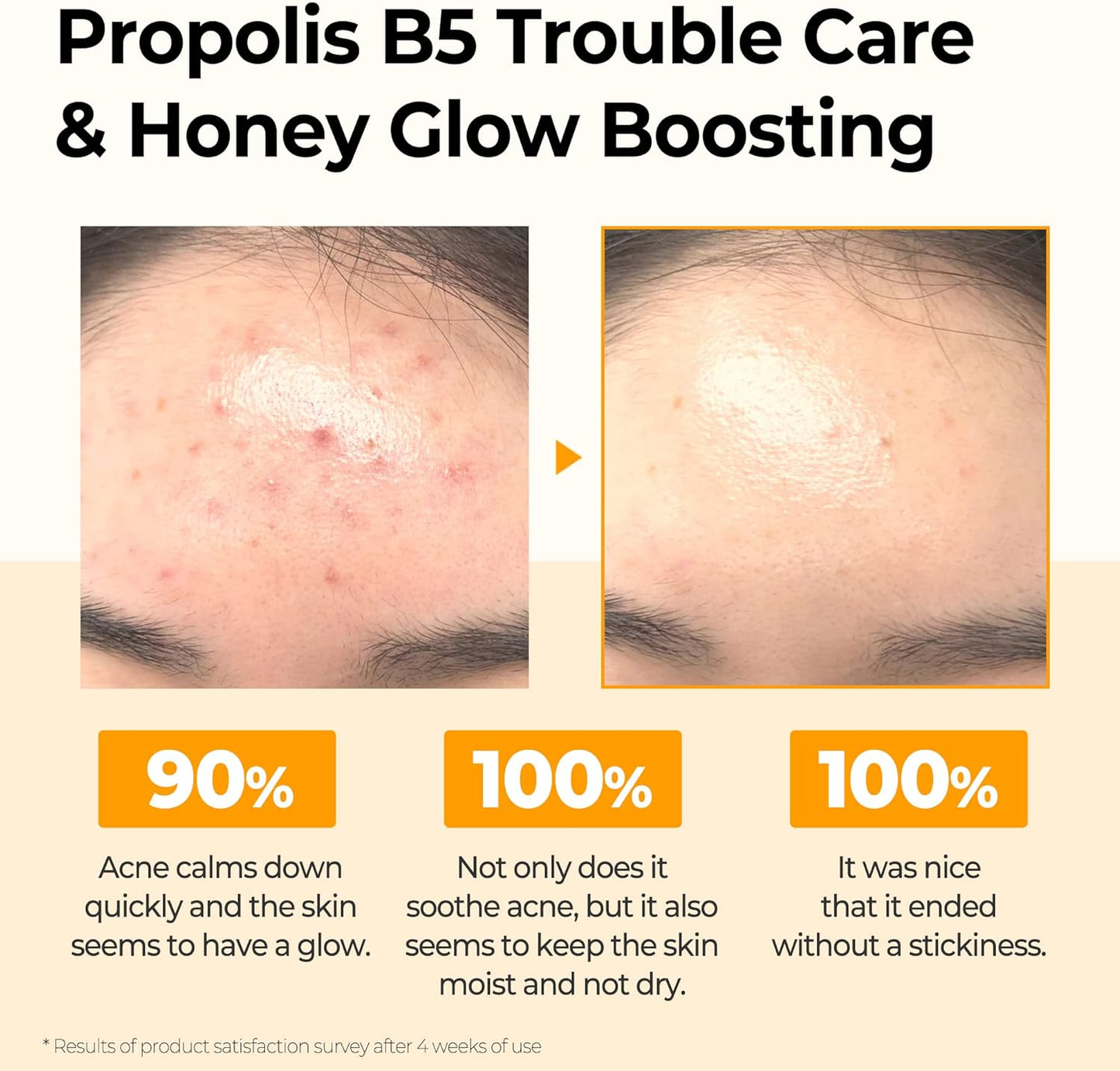 Propolis B5 Glow Barrier Calming Toner / 5.07Oz, 150Ml / Strengthen Skin Barrier with Honey Extracts/Brightening and Skin Calming Effect, Sebum and Pimple Care/Facial Skin Care