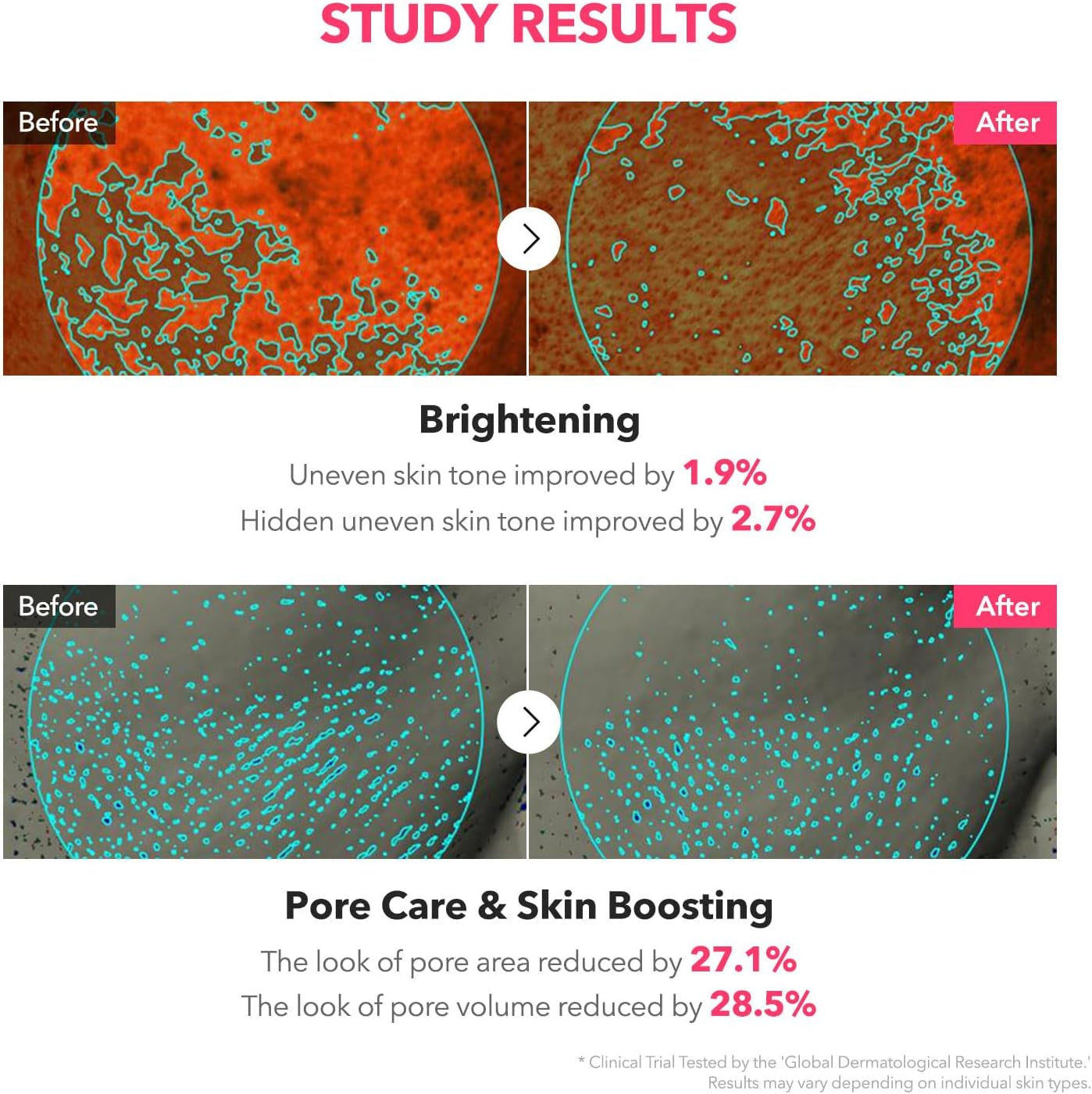 TXA Niacinamide Toning Shot 99 Spicule Facial Serum|Skin Booster Serum for Brightening and Pore Care|99% High-Purity Tranexamic Acid 3% + Niacinamide 5%|Korean Skin Care|1.01 Fl. Oz.