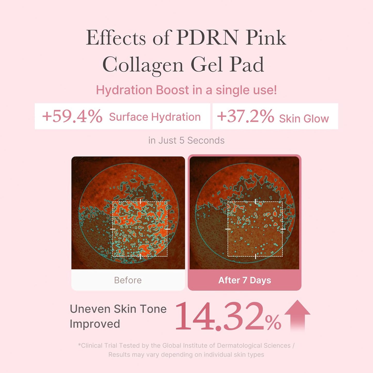 Salmon DNA PDRN Pink Collagen Jelly Pad | Korean Gel Toner Pads with Niacinamide, Madecassoside, Retinol | Soothing, Radiance & Uneven Skin Tone | Korean Skin Care | 70Pads