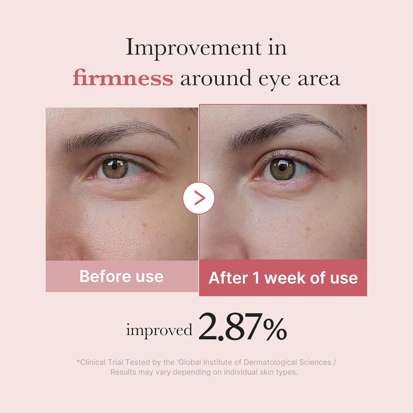Salmon DNA PDRN Pink Peptide Eye Serum with Niacinamide and 99% Purity Retinol for Fine Lines, Uneven Skin Tone, Korean Skin Care 1.01Fl.Oz