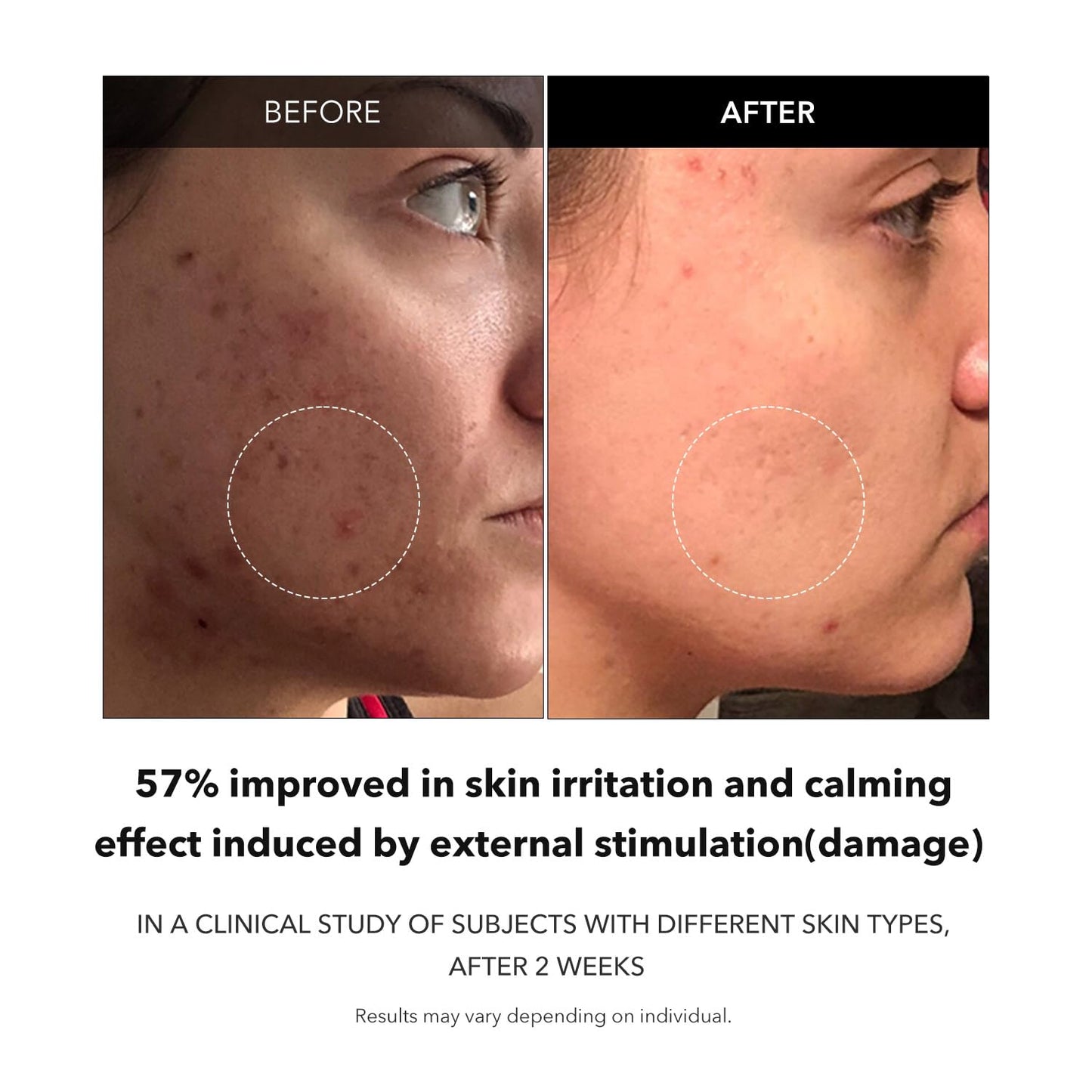 Carrotene Clarifying Facial Serum | Vegan, Non-Comedogenic | Blemish Clear, Dark Spot Corrector | Korea Skincare | Oily Skin, Sensitive Skin, Bumpy Skin | 1.25 Fl.Oz