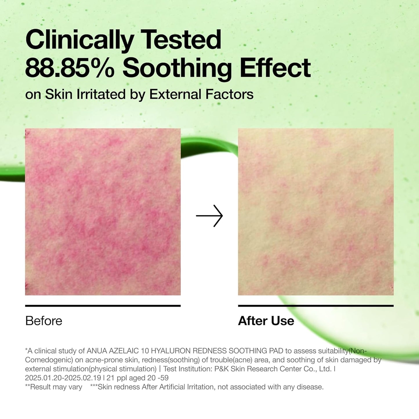 Azelaic 10 Hyaluron Redness Soothing Pad, Troubled & Spot Care with Korean Toner Pads, Quick & Easy Stretchable Facial Mask with Azelaic Acid, Hyaluronic Acid, Korean Skin Care (90 Pads)
