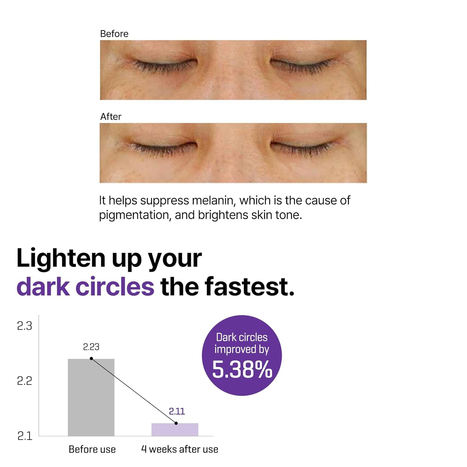 Retinol Intense Advanced Triple Action Eye Cream – 1.01Oz, 30Ml – Korean Retinol under Eye Cream anti Aging for Fine Lines – Brightens Dark Circles & Smooths Skin Texture – Korean Skin Care