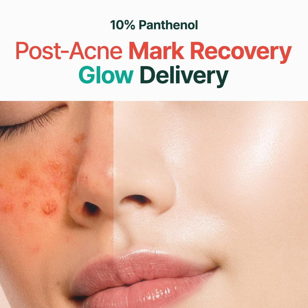 Post-Acne Moisturizer, Recovery & Glow Boost, Silicone-Free, Non-Comedogenic, Vegan, Korean Skincare, Mighty Bamboo Panthenol Cream, 3.38 Fl Oz / 100Ml