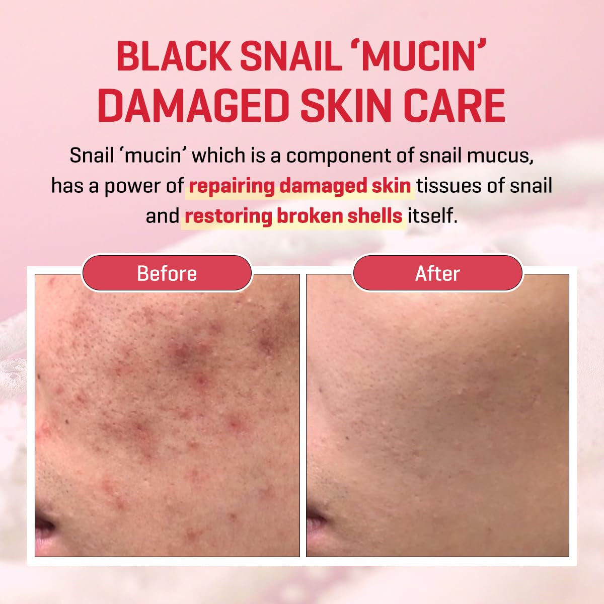 Snail Truecica Miracle Repair Low Ph Gel Cleanser - 3.38Oz, 100Ml - Made from Snail Mucin for Sensitive Skin - Daily Face Wash for Deep Cleansing and Skin Moisturizing - Korean Skin Care