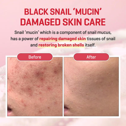 Snail Truecica Miracle Repair Low Ph Gel Cleanser - 3.38Oz, 100Ml - Made from Snail Mucin for Sensitive Skin - Daily Face Wash for Deep Cleansing and Skin Moisturizing - Korean Skin Care