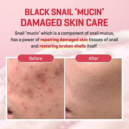Snail Trucica Miracle Repair Serum - 1.69Oz, 50Ml - Made from Snail Mucin for Sensitive Skin - Daily Repair Face Serum for Post Acne Marks and Strengthen Skin Barrier - Korean Skin Care
