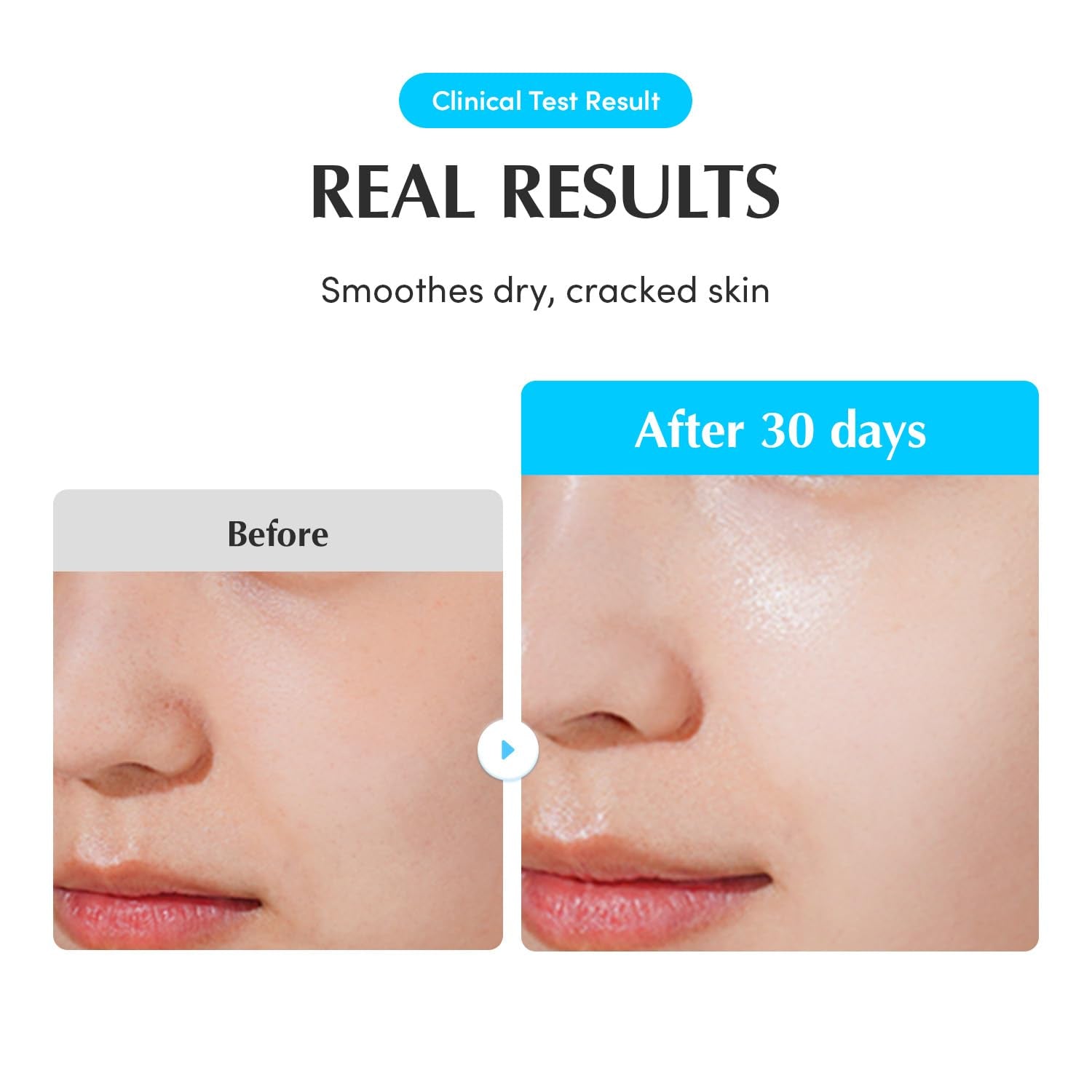 Swimming Pool Ampoule - Hyaluronic Acid Serum for Glass Skin | Deep Hydration and Soothing with CICA Extracts | Korean Skin Care Serum, 1.69 Fl. Oz. 50Ml