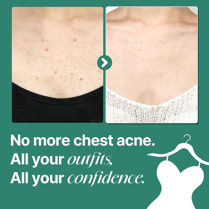 AHA BHA PHA 30 Days Miracle Acne Clear Body Cleanser - 13.5Oz, 400Ml - Daily Exfoliating Tea Tree Acne Body Wash with Salicylic Acid - Deep Cleanses Sebum and Impurities - Korean Skin Care