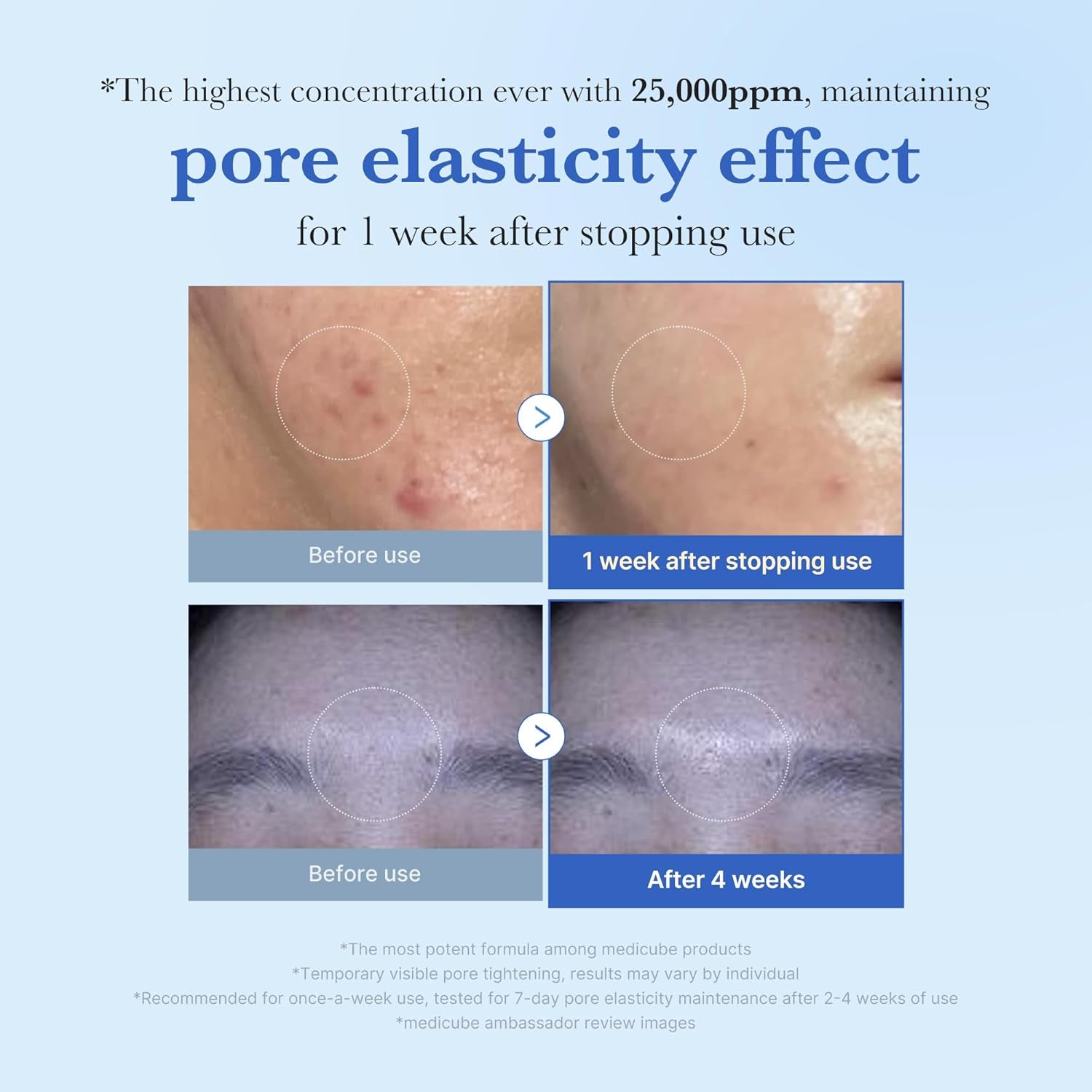 Zero Exosome Shot 25,000 PPM Spicule Facial Serum | Liquid Skin Booster Serum | Exosome, AHA+BHA+PHA | Pore Care, Dead Skin Cells, Skin Texture | Korean Skin Care 0.43 Fl.Oz