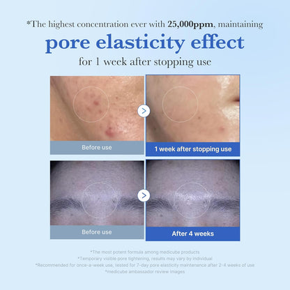 Zero Exosome Shot 25,000 PPM Spicule Facial Serum | Liquid Skin Booster Serum | Exosome, AHA+BHA+PHA | Pore Care, Dead Skin Cells, Skin Texture | Korean Skin Care 0.43 Fl.Oz