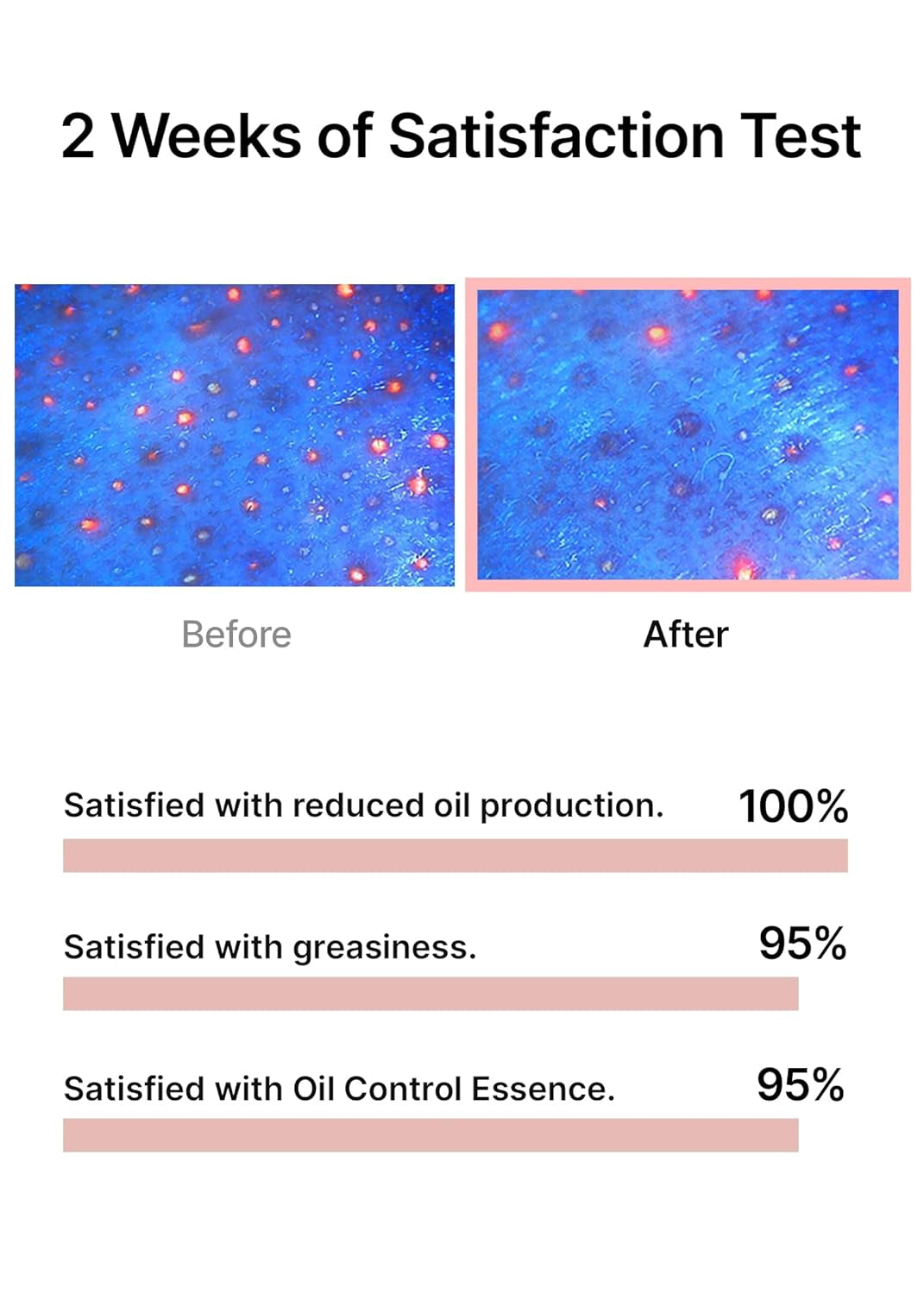 Oil Control Capsule Essence | with Tea Tree Extract, for Sebum Reducing Serum, Mattifying, Hydrating, Moisturizing Mild Formula for Sensitive, 30Ml