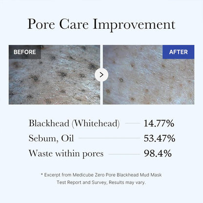Zero Pore Blackhead Mud Facial Mask - Skin Cooling & Pore Tightening - 3 Minute Quick Dry Formula with AHA, BHA, PHA, and Pore-Purifying Clay - Korean Mud Mask 3.52 Oz