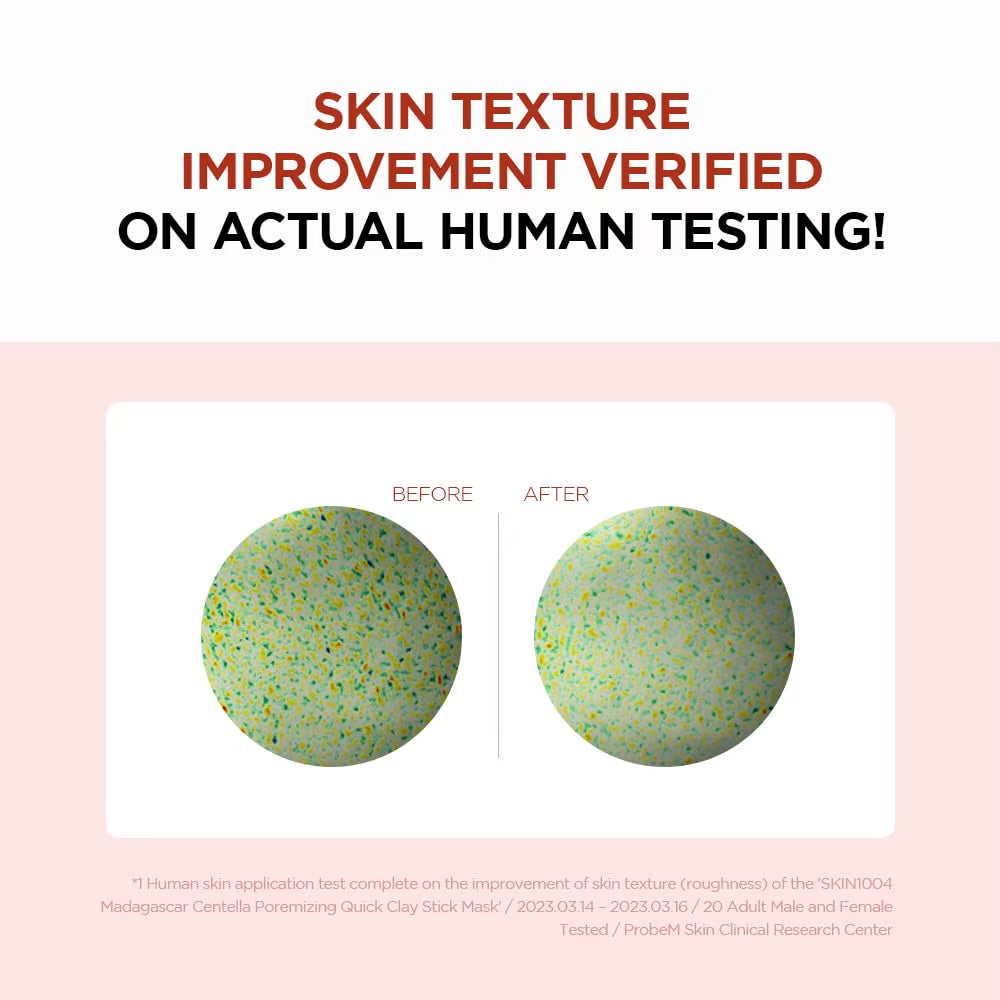 SKIN1004 Madagascar Centella Asiatica Acne Quick Clay Stick Mask Moisturizing and Nourishing Skin Korean Skincare 27G