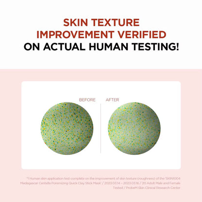 SKIN1004 Madagascar Centella Asiatica Acne Quick Clay Stick Mask Moisturizing and Nourishing Skin Korean Skincare 27G