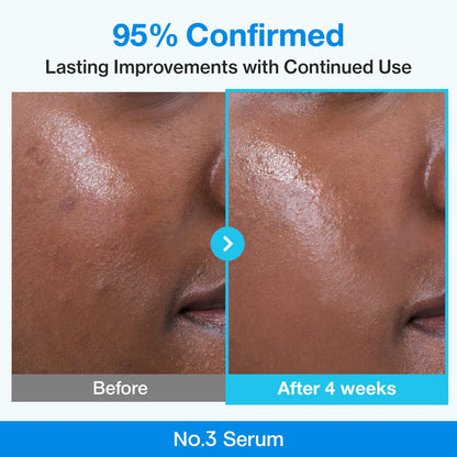 No.3 Retinol Serum | Blue Bio-Retinol Pore Refining Serum | Tightening, Firming, Korean Skincare | Niacinamide, Peptide, Salicylic Acid (BHA) | Beginner-Friendly Retinol | 1.01 Fl.0Z