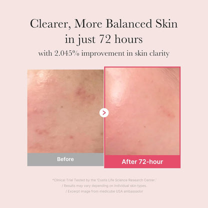 Txa+Niacinamide 15% Glow Facial Serum for after Spot Care | All-In-One Daily Korean Skincare | Uneven Skin Tone, Texture, and Hydration Care | High-Potency Tranexamic Acid 5% | 1.01 Fl.Oz