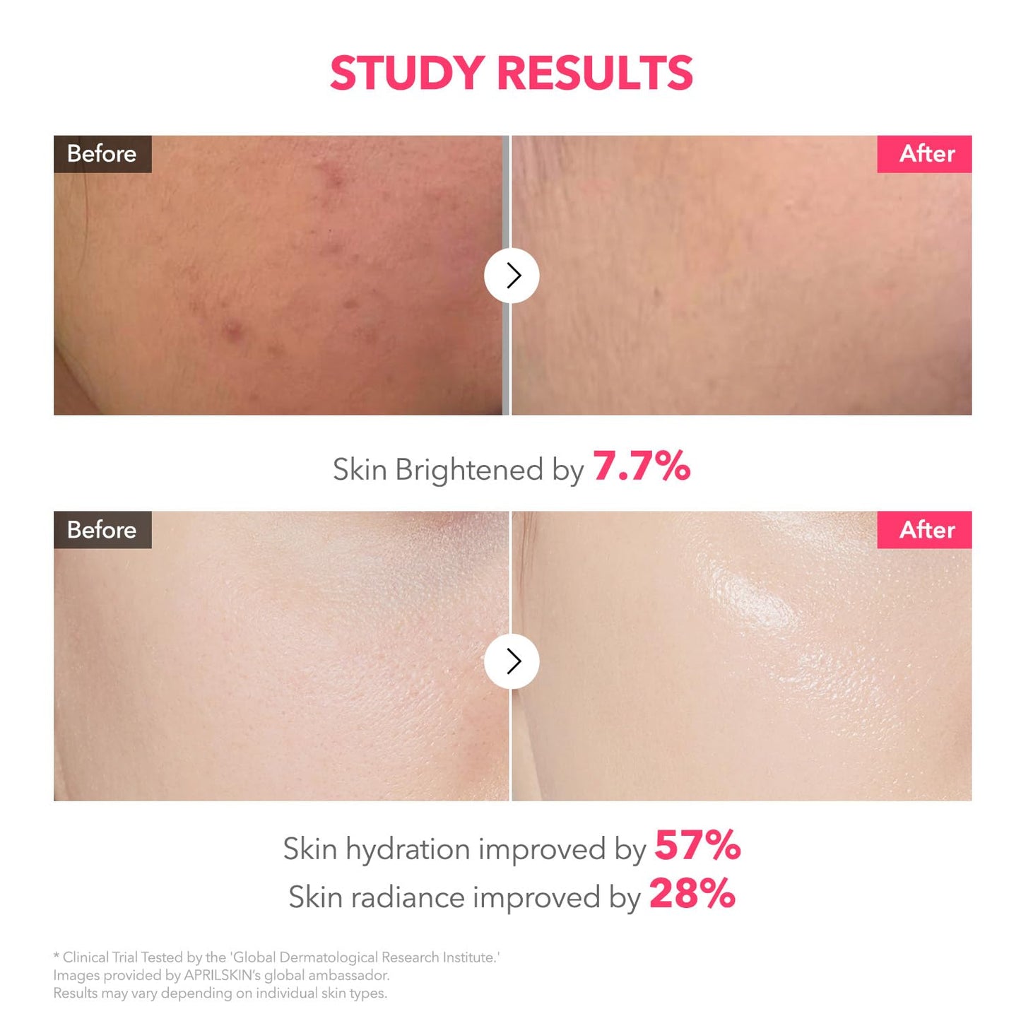 TXA Pink Capsule Gel Mask | Overnight Face Mask for Glass Glow Skin I 99% High-Purity Tranexamic Acid 3 for Uneven Skin Tone I Elasticity, Hydrating and Firming I Korean Skincare I 30G X 4Ea