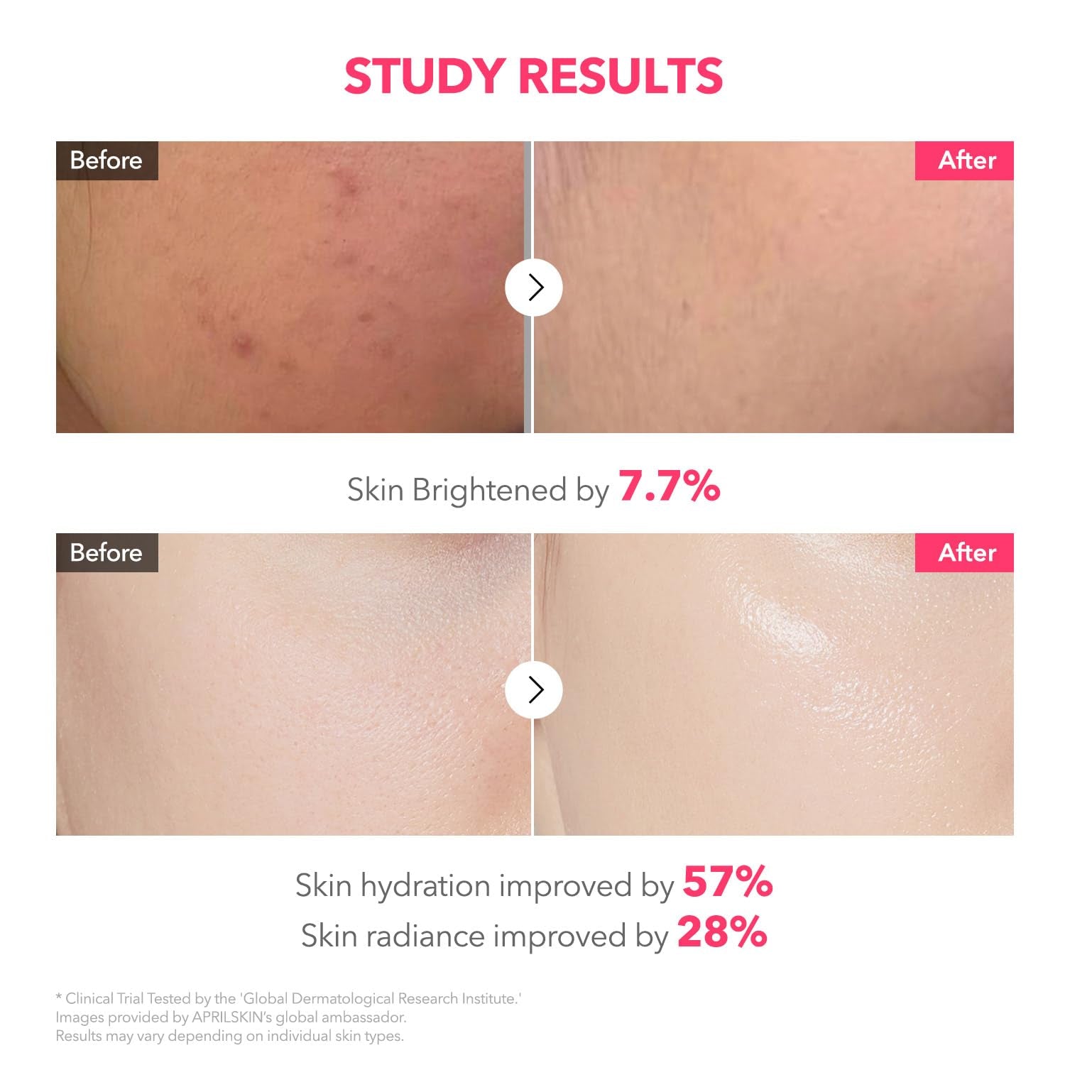 TXA Pink Capsule Gel Mask | Overnight Face Mask for Glass Glow Skin I 99% High-Purity Tranexamic Acid 3 for Uneven Skin Tone I Elasticity, Hydrating and Firming I Korean Skincare I 30G X 4Ea