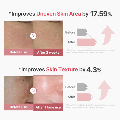 PDRN Pink Collagen Exosome Shot Serum 2,000 PPM | Liquid Skin Booster | Exosome, Salmon DNA PDRN, Spicules | Uneven Skin Tone, Pore Care, Skin Texture | Korean Skin Care 1.01 Fl.Oz