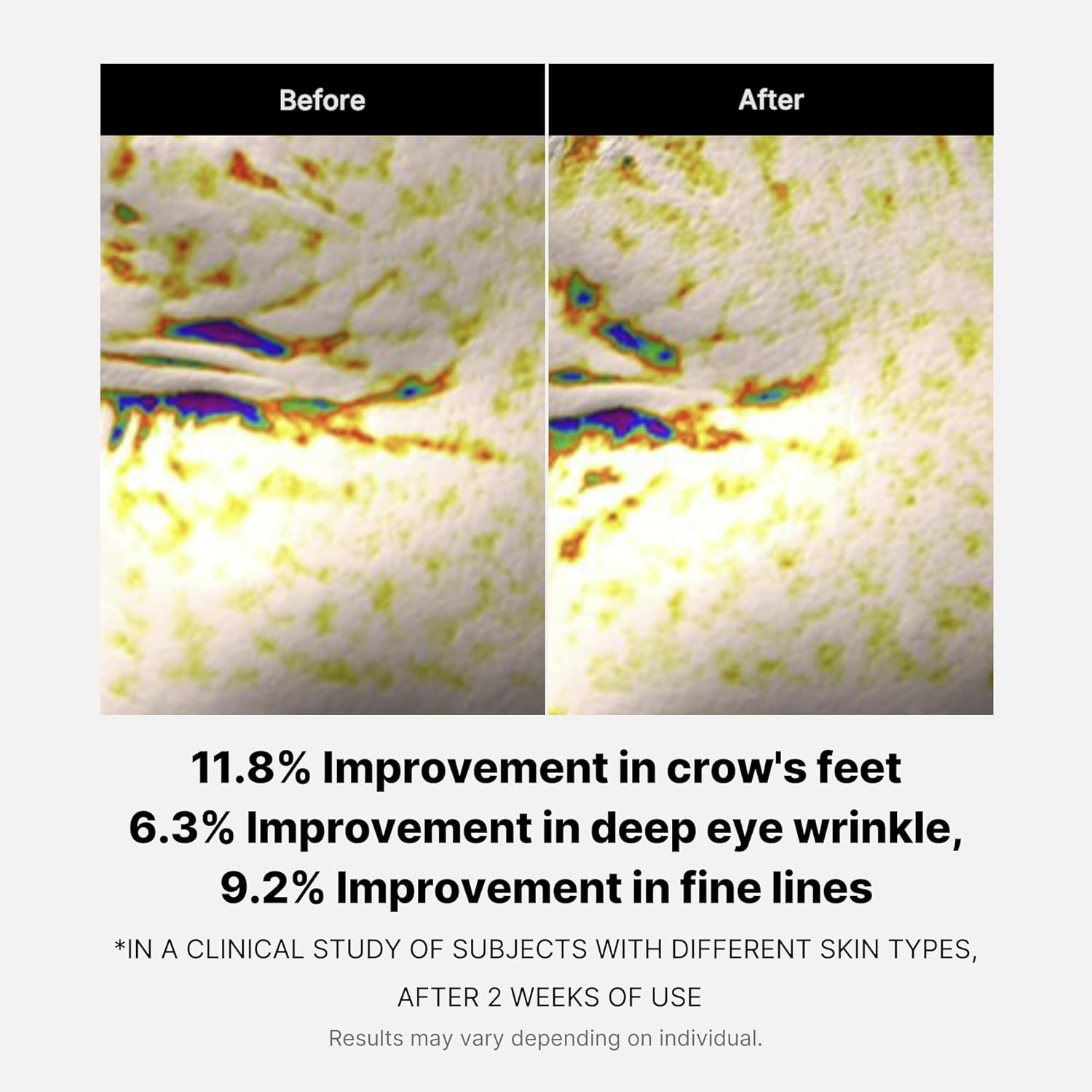 Deep Reviving Peptide Eye Serum 1.01 Fl. Oz., | Eye Treatment Serum with Quadruple Peptides, Niacinamide, and Squalane | Reduces Signs of Aging and Fine Lines