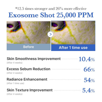 Zero Exosome Shot 25,000 PPM Spicule Facial Serum | Liquid Skin Booster Serum | Exosome, AHA+BHA+PHA | Pore Care, Dead Skin Cells, Skin Texture | Korean Skin Care 0.43 Fl.Oz