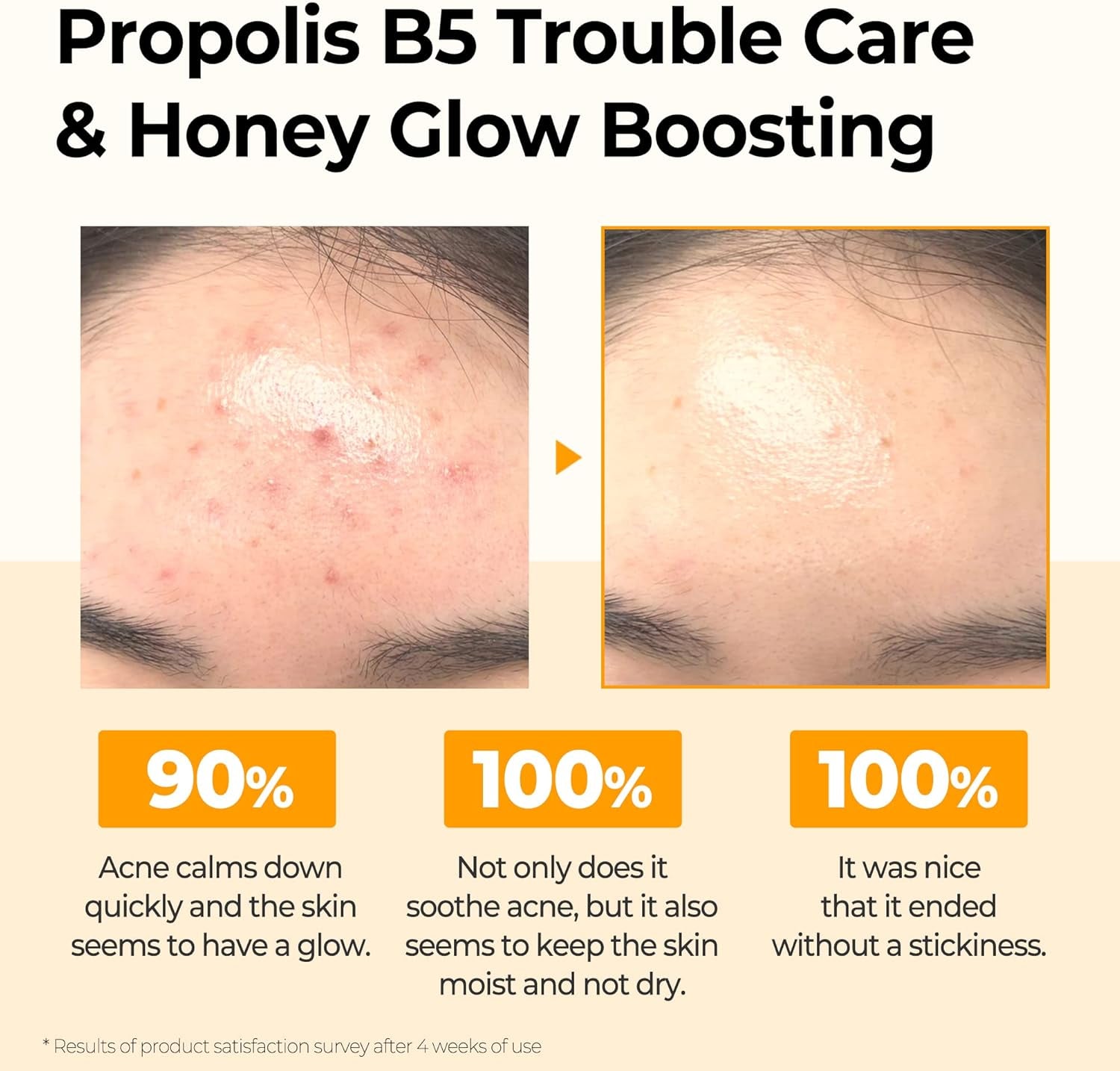 Propolis B5 Glow Barrier Calming Toner / 5.07Oz, 150Ml / Strengthen Skin Barrier with Honey Extracts/Brightening and Skin Calming Effect, Sebum and Pimple Care/Facial Skin Care