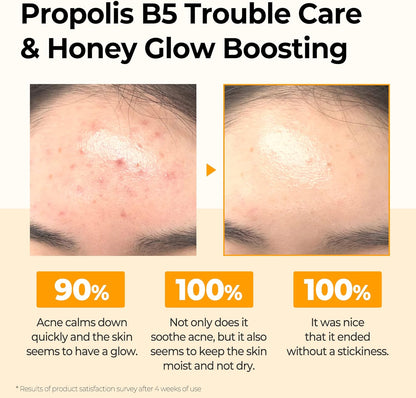 Propolis B5 Glow Barrier Calming Toner / 5.07Oz, 150Ml / Strengthen Skin Barrier with Honey Extracts/Brightening and Skin Calming Effect, Sebum and Pimple Care/Facial Skin Care