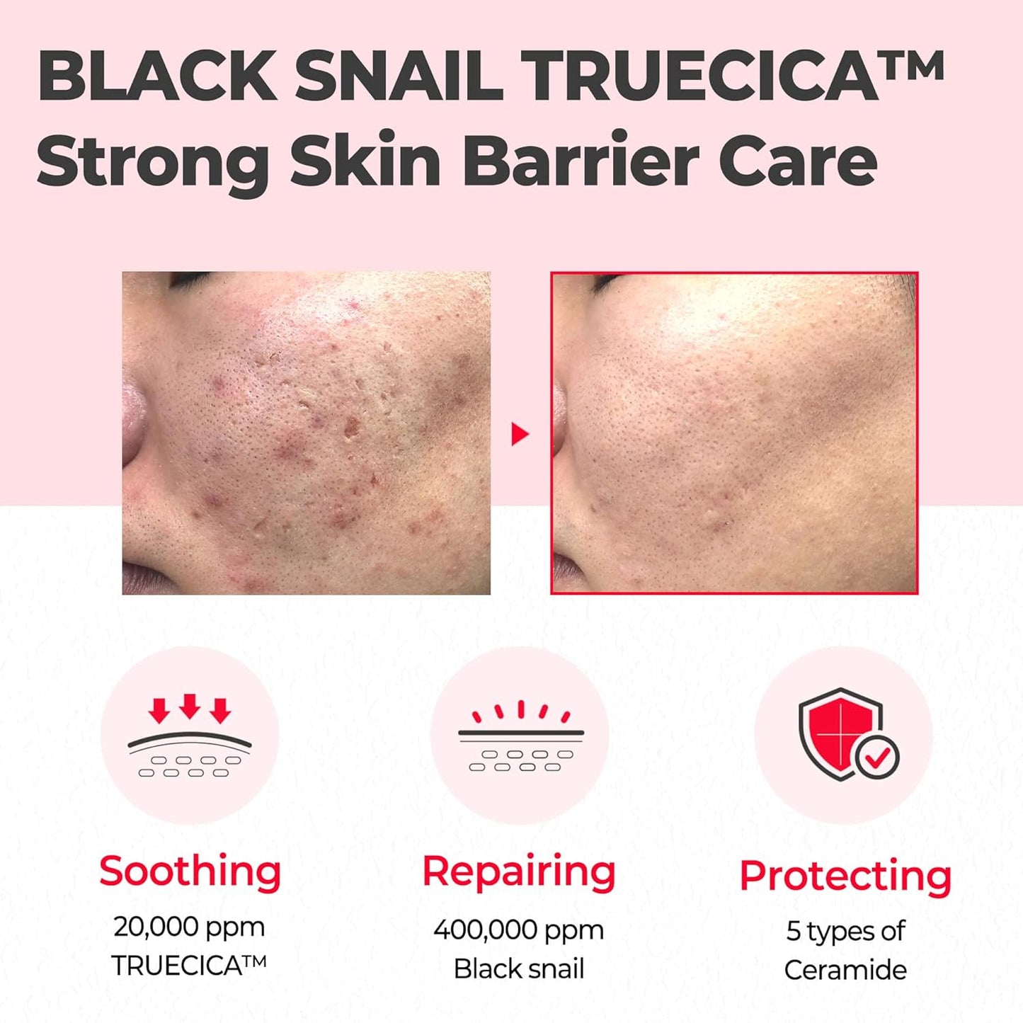Snail Truecica Miracle Repair Cream - 2.02Oz, 60Ml - Made from Snail Mucin for Sensitive Skin - Daily Repair Face Moisturizer for Acne Marks and Strengthen Skin Barrier - Korean Skin Care