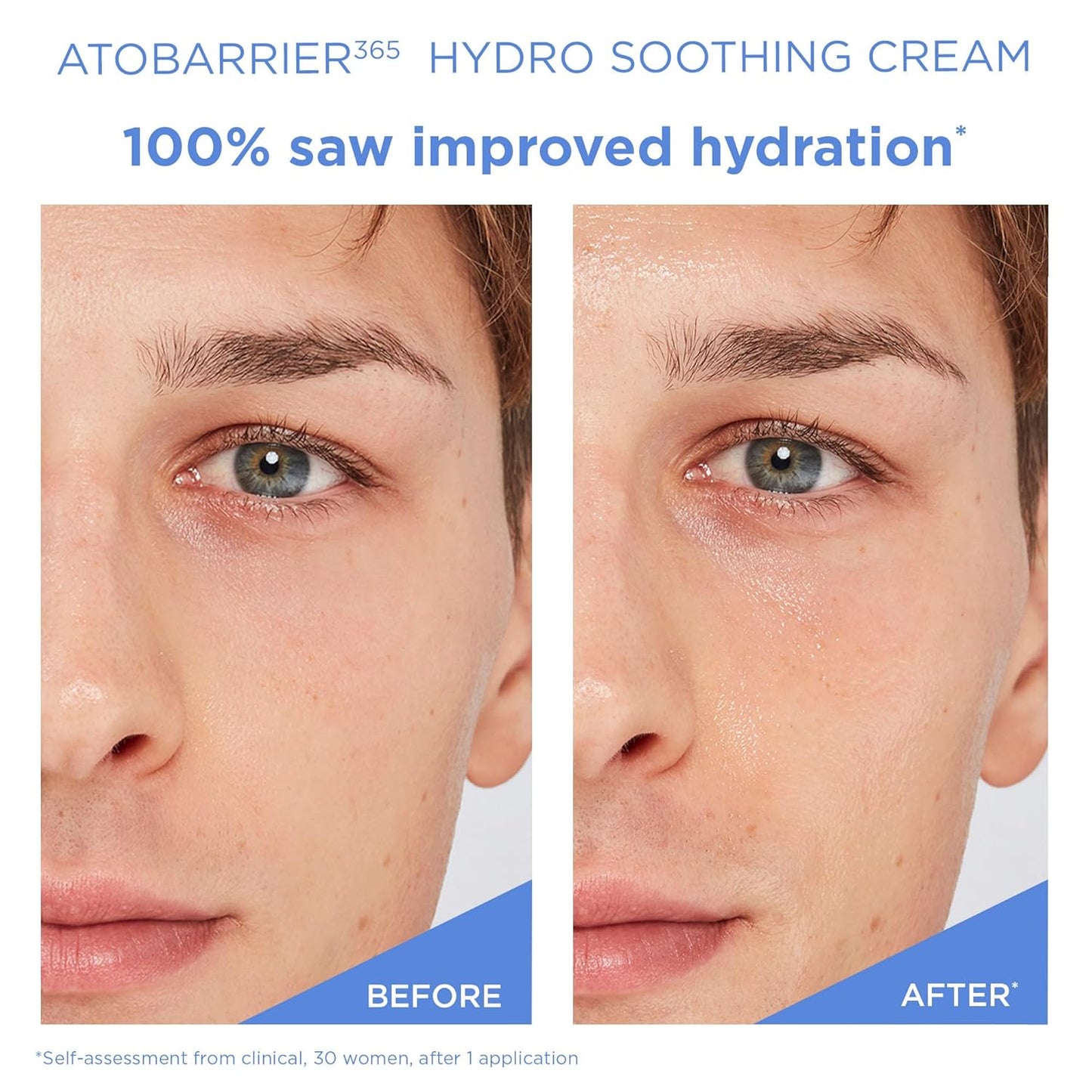 ATOBARRIER365 Hydro Soothing Gel Cream Moisturizer with Ceramides for Moisture Barrier Repair | Lightweight Hydration, Instant Cooling, Suitable for Sensitive Skin, 60ML / 2.03 Fl.Oz.