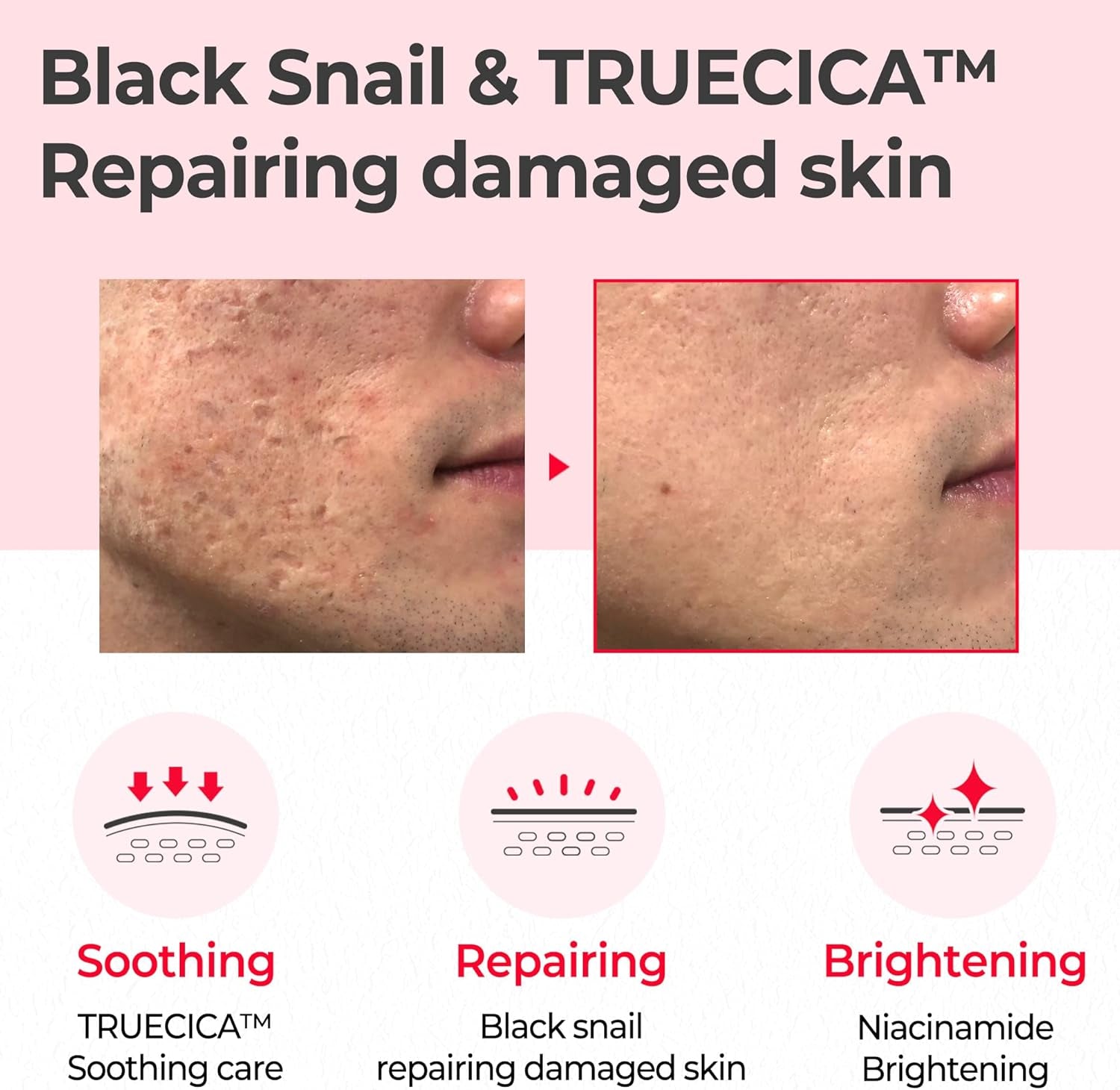 Snail Truecica Miracle Repair Toner - 4.6Oz, 135Ml - Made from Snail Mucin for Sensitive Skin - Daily Repair Face Toner with Skin Texture and Pigmentation Care - Korean Skin Care