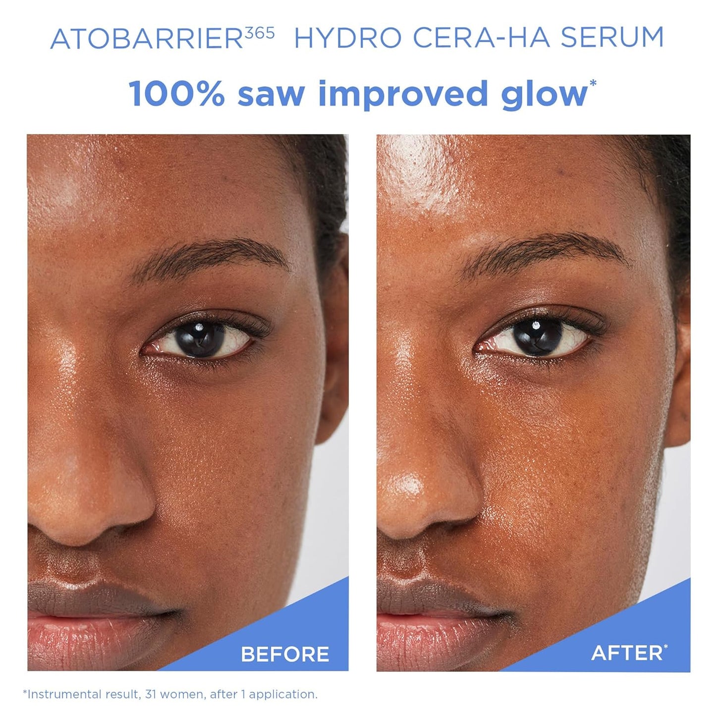 ATOBARRIER365 Hydro CERA-HA Face Serum with Ceramide, Hyaluronic Acid, and Niacinamide for Skin Moisture Barrier Repair | Deep Hydration, Suitable for Dry & Sensitive Skin, 30ML / 1.01 Fl.Oz.