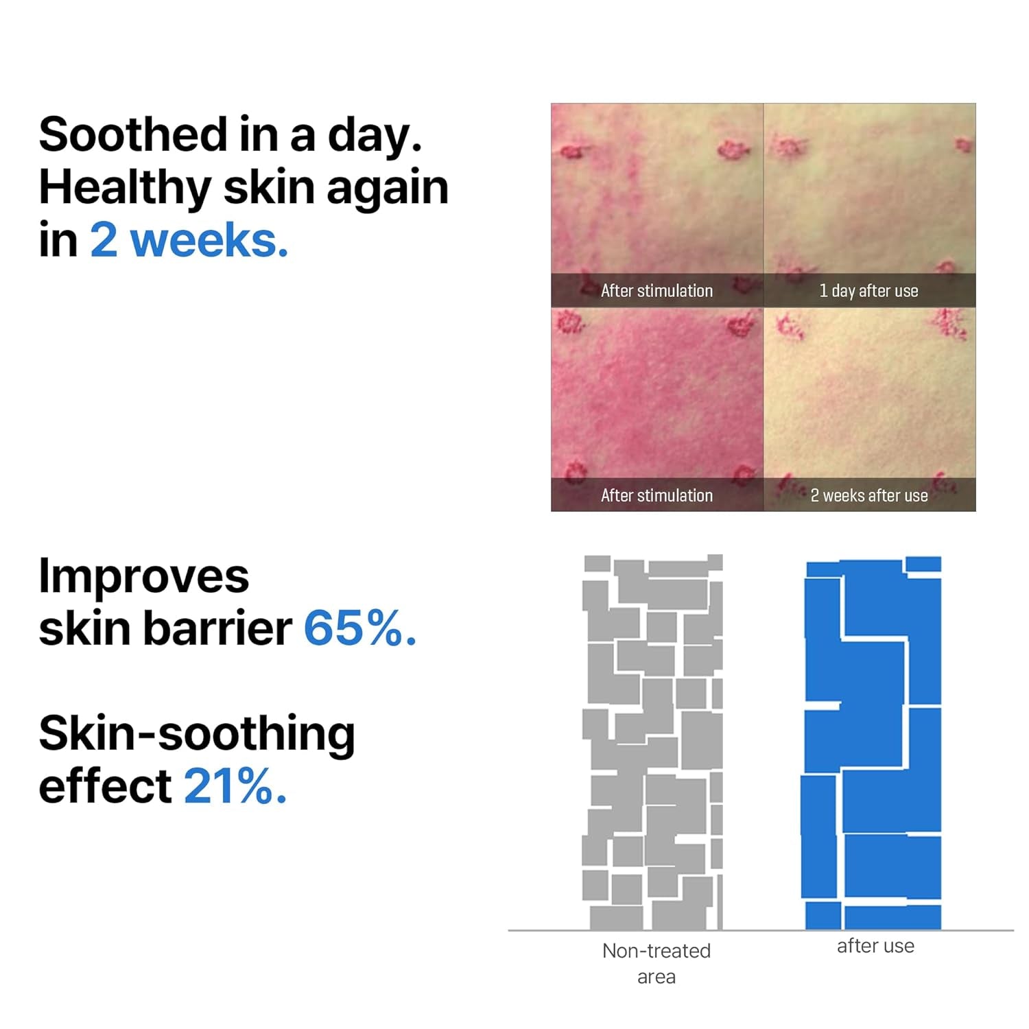 Beta-Panthenol Repair Serum – 1.01Oz, 30Ml – Korean Hydrating Hyaluronic Acid Serum for Face – Daily Barrier Repair & Soothing Formula with Beta-Sitosterol & Panthenol – Korean Skin Care