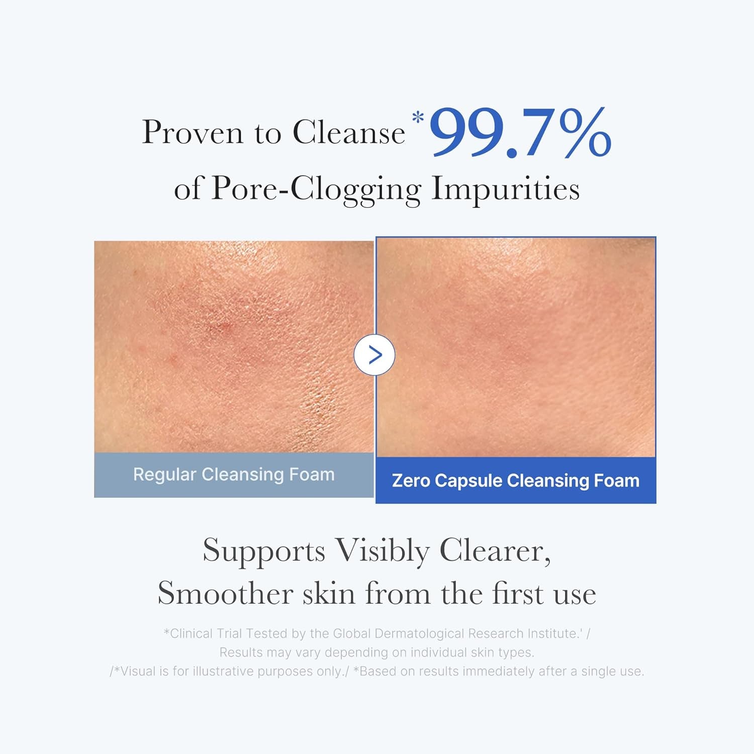 Zero Pore Clear Blue Capsule Facial Deep Cleanser for Skin Texture, Blackhead & Pore Care | AHA, BHA & PHA for Double Cleansing, Daily Gentle Face Wash, Korean Skincare | 120G / 4.23 Oz