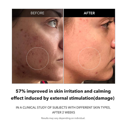Carrotene Clarifying Facial Serum | Vegan, Non-Comedogenic | Blemish Clear, Dark Spot Corrector | Korea Skincare | Oily Skin, Sensitive Skin, Bumpy Skin | 1.25 Fl.Oz