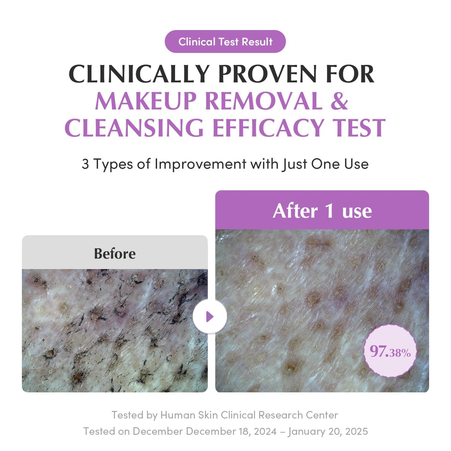 Purple Rice Pore Smoothing Cleansing Oil – Deep Cleansing for Pores & Blackheads | Korean Oil Cleanser for Face & Makeup Remover | Hydrating & Soothing Formula, 6.76 Fl.Oz