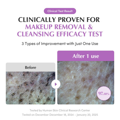Purple Rice Pore Smoothing Cleansing Oil – Deep Cleansing for Pores & Blackheads | Korean Oil Cleanser for Face & Makeup Remover | Hydrating & Soothing Formula, 6.76 Fl.Oz