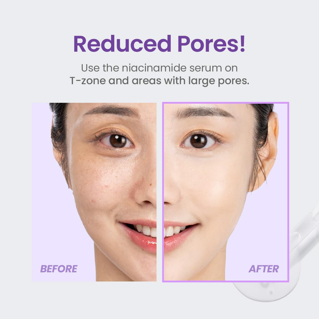 Niacinamide 20% Serum 30Ml
