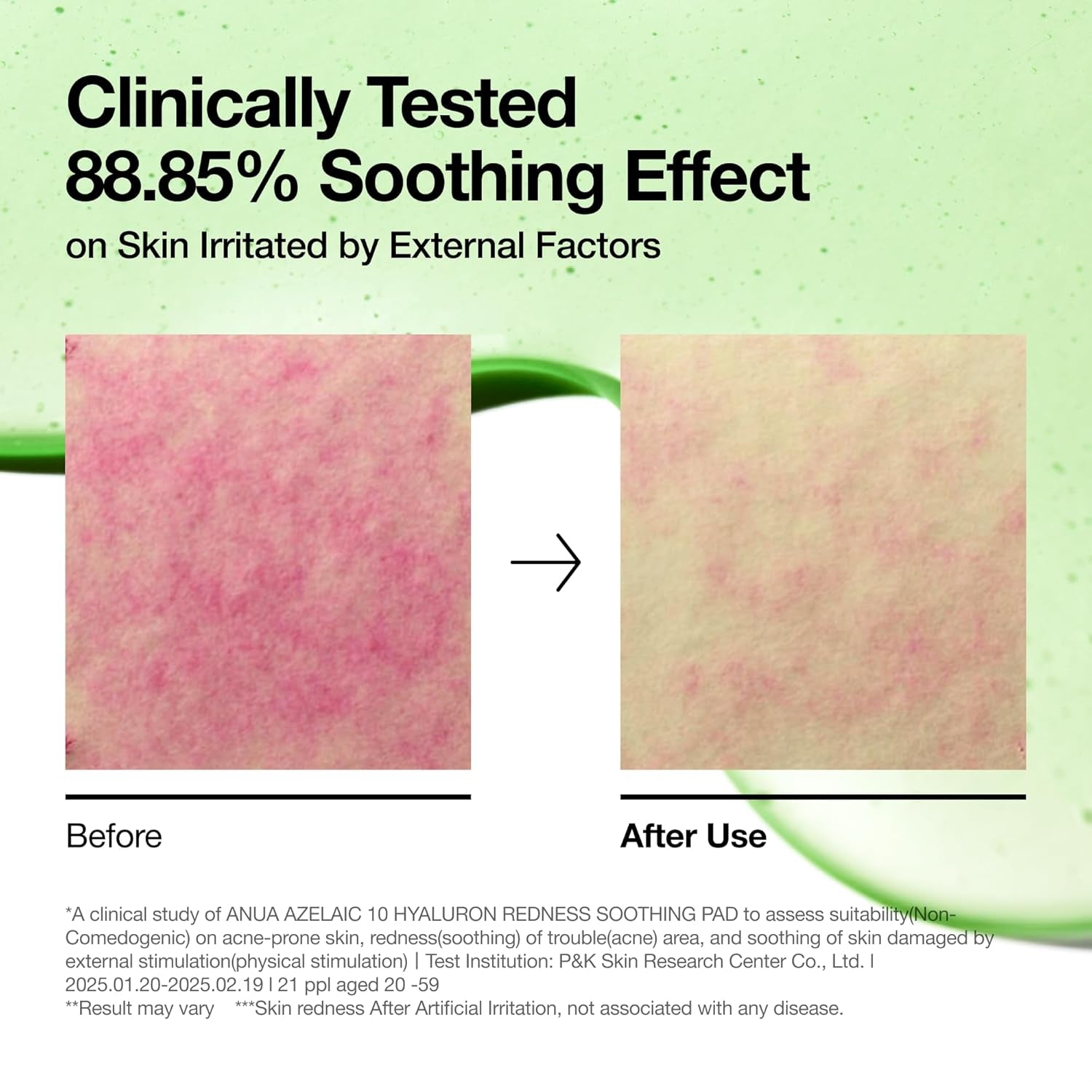 Azelaic 10 Hyaluron Redness Soothing Pad, Troubled & Spot Care with Korean Toner Pads, Quick & Easy Stretchable Facial Mask with Azelaic Acid, Hyaluronic Acid, Korean Skin Care (90 Pads)