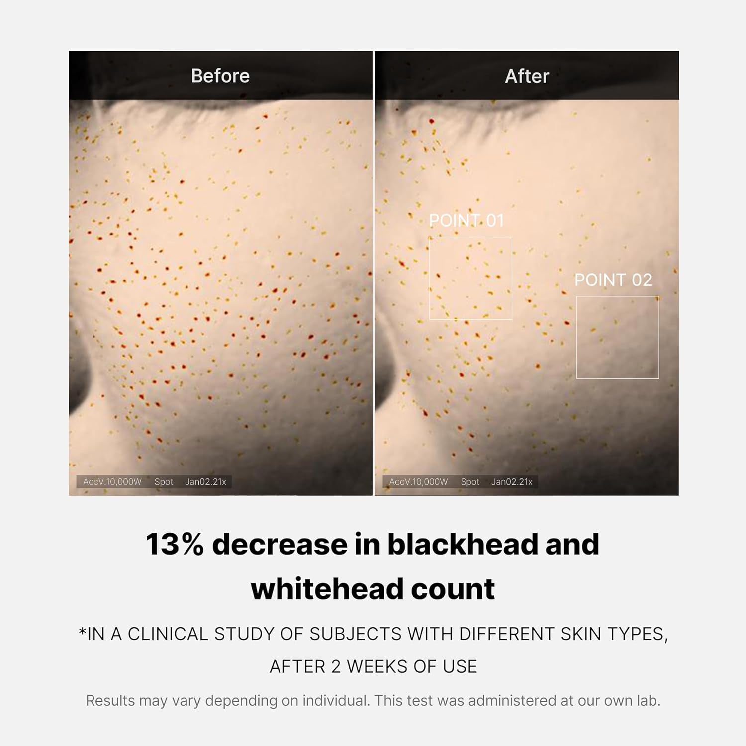 Zero Pore One-Day Serum 1.01 Fl.Oz - Overnight Resurfacing Serum with Pore Tightening Complex - 15.2% AHA+BHA+PHA & 2% Niacinamide - 10.8% Reduction in Pore Appearance after One Day of Use