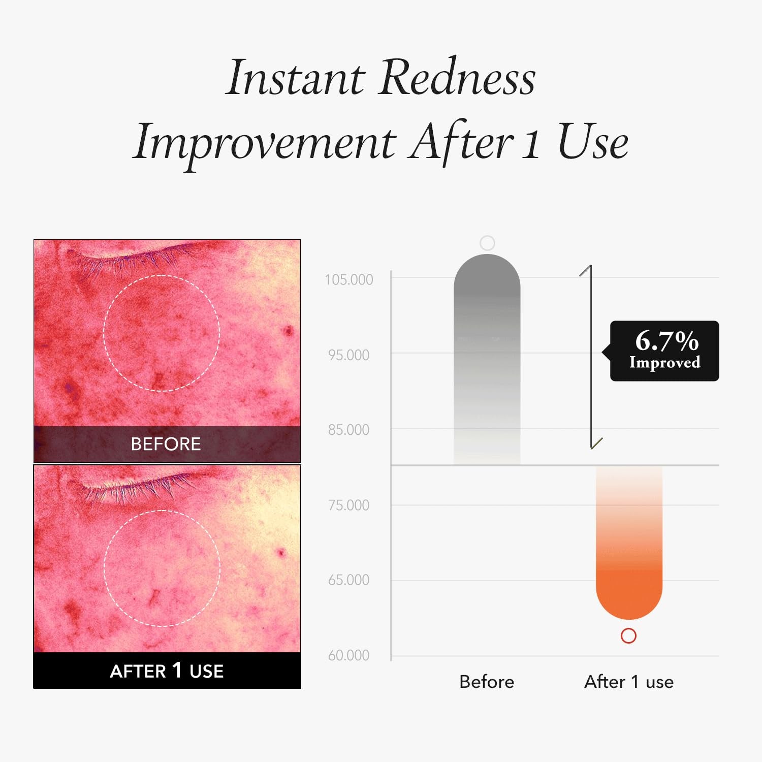 Carrotene IPMP™ Instant Calming Serum Toner Pads | 5-Minute Cooling Serum Pads | Vegan, Cruelty-Free | Non-Comedogenic | Toner-Serum-Sheet Mask All-In-One | Korean Skin Care, 80 Pads