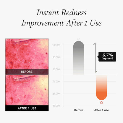 Carrotene IPMP™ Instant Calming Serum Toner Pads | 5-Minute Cooling Serum Pads | Vegan, Cruelty-Free | Non-Comedogenic | Toner-Serum-Sheet Mask All-In-One | Korean Skin Care, 80 Pads