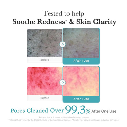 Azelaic Acid Gummy Whip Cleanser | Cleansing Foam for Troubled Skin | Use after Spot Care & Excess Sebum Control | Niacinamide, Glycerin | Soothing, Pore Cleansing Face Wash | Korean Skincare
