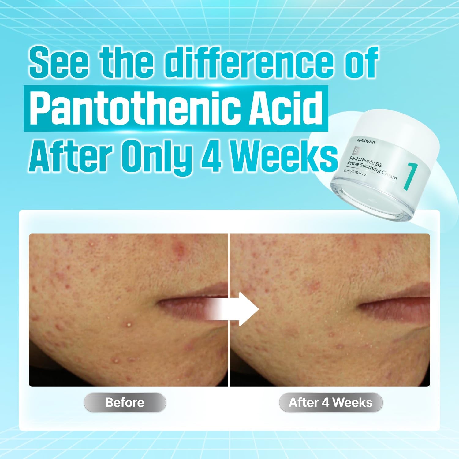 No.1 Pantothenic B5 Active Soothing Cream | Remove Sebum and Skin Troubles, Pantothenic Acid, Korean Skincare Gift for Women | 2.70 Fl Oz