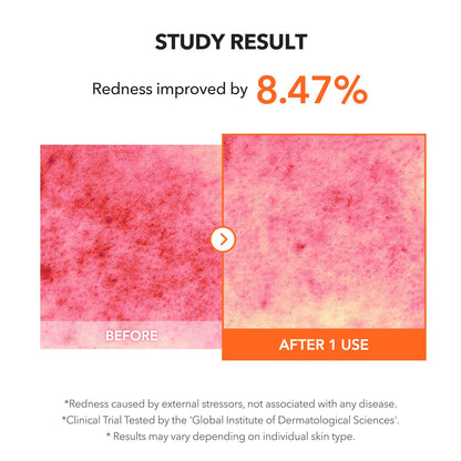Carrotene IPMP™ Clearing Solution || Quickly Soothes Troubled Areas and Helps Clear Blemishes | Formulated with BHA, AHA, Niacinamide & Zinc Oxide | Vegan, Cruelty-Free (0.67Fl.Oz.)